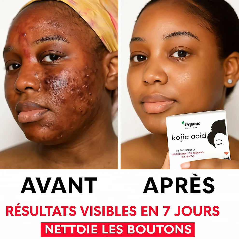 Savon Kojic San : Éclat Naturel, Peau Nette, Fraîche & Éclatante